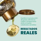 Shampoo Anyeluz Romero Cebolla Ácido Hialurónico Sin Sal X 500ml